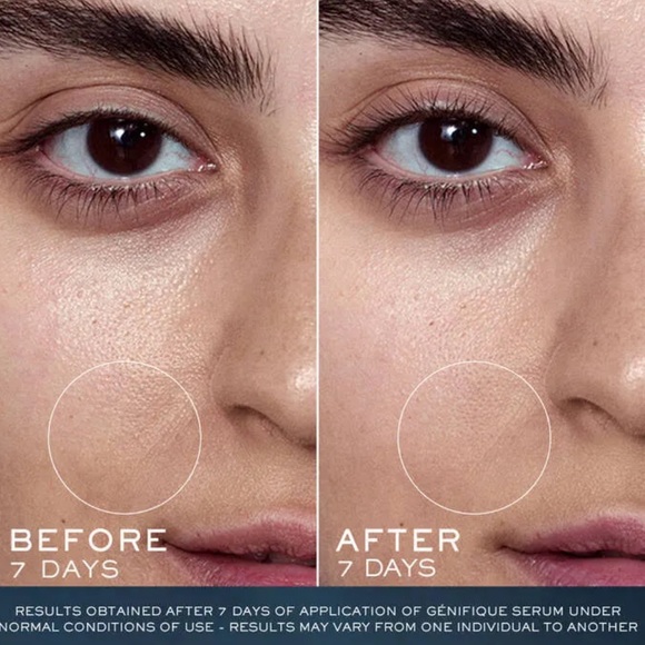 ADVANCED GÉNIFIQUE SENSITIVE SERUM 20 ml - Picture 4 of 7